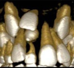 3D Computer Images