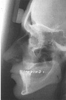 Flat 2-dimensional x-ray image