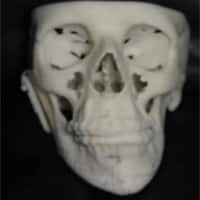 SLA model grown from computer simulation
