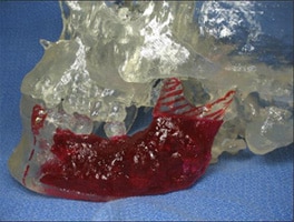 computer guided imaging