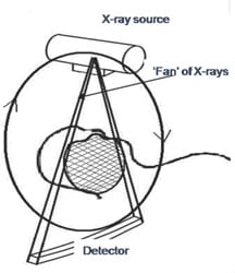 Cone beam CT technology
