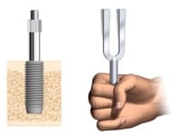 Dental Implant Technology