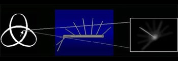 Panorex, a dental tomogram