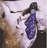 Partial Replacement Joint