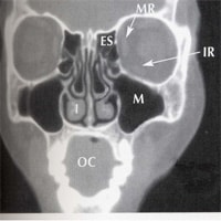 Computer tomography