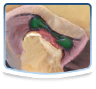 jaw jaw diagram