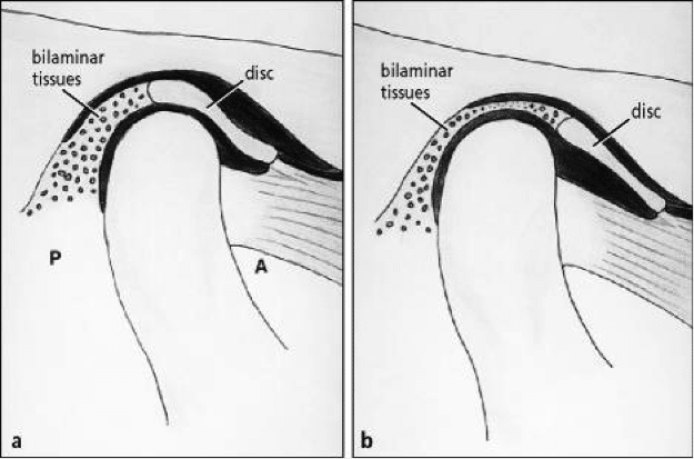 jaw2 jaw diagram showing bilaminar tissues