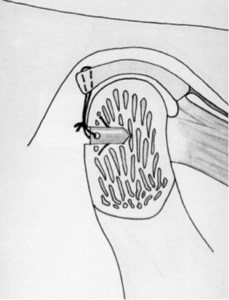 jaw3