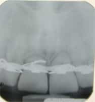 Cone Beam CT Pompano Beach FL