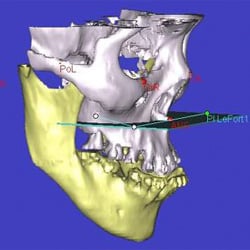 computer jaw position 1