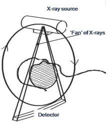 cone beam 1