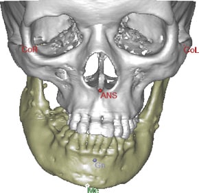 orthognathic 2