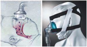 Sleep Apnea Masks Sultan Oral Surgery