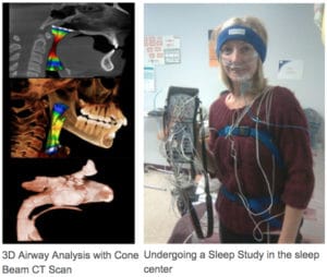 airway analysis with CT scan and woman ready for a sleep study