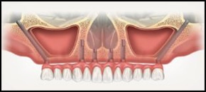 dental1 1