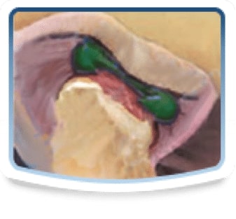 jaw