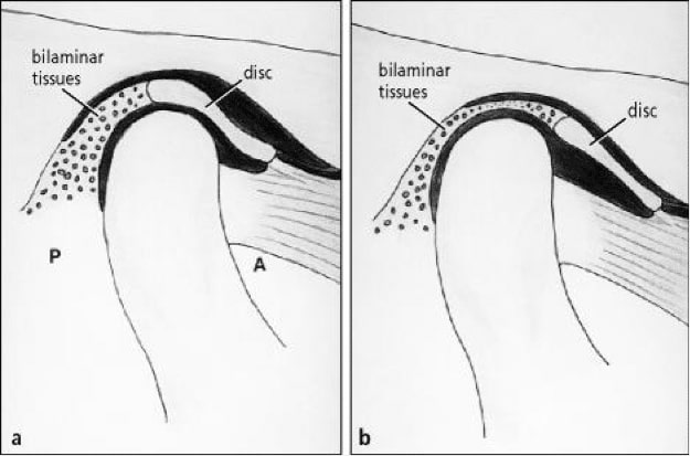 jaw2