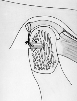 jaw3