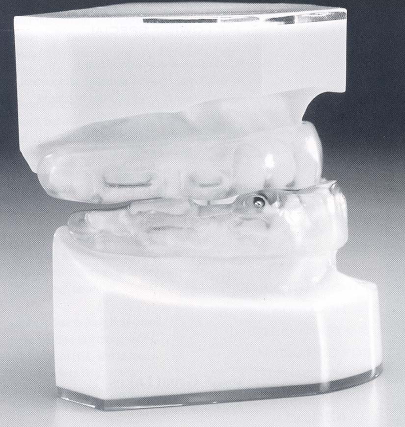 oral appliance1