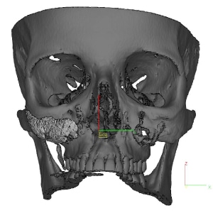 cheek image1