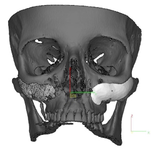 cheek image2