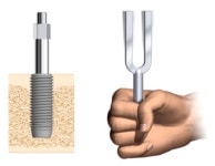 dental implant technology 2