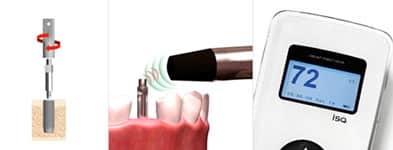 dental implant technology 3
