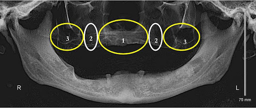 dental