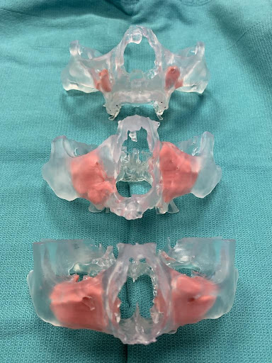 Varying degrees of bone atrophy using 3D models