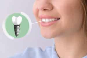 Woman receives a dental implant to fill in a missing upper tooth
