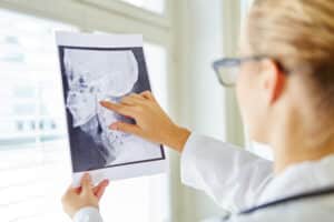 Doctor analyzing an x-ray during a consultation about corrective jaw surgery, or orthognathic surgery