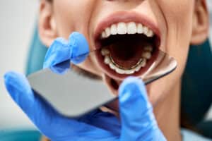 Looking in a patient's mouth to determine if a lump is a cyst or tumor