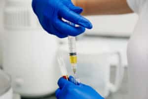 Doctor holds PRP vile in preparation to improve healing from bone grafting for dental implant