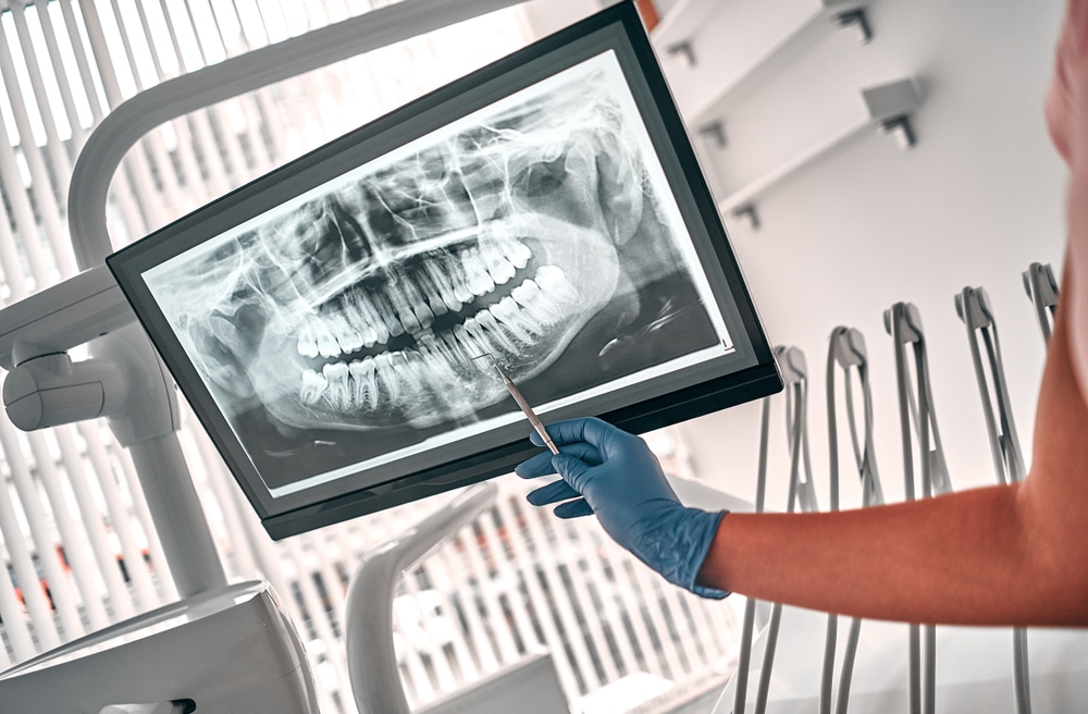 Oral facial surgeon shows a digital image of a patient's mouth before surgery.